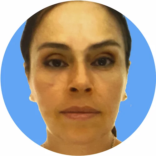 Dott.ssa Elioda Bega, pneumologa